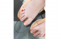 Аку тейп | BB ACU TAPE