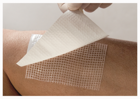 Очищающая атравматическая повязка на рану с химотрипсином | ПараПран