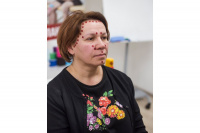 Аку тейп | BB ACU TAPE